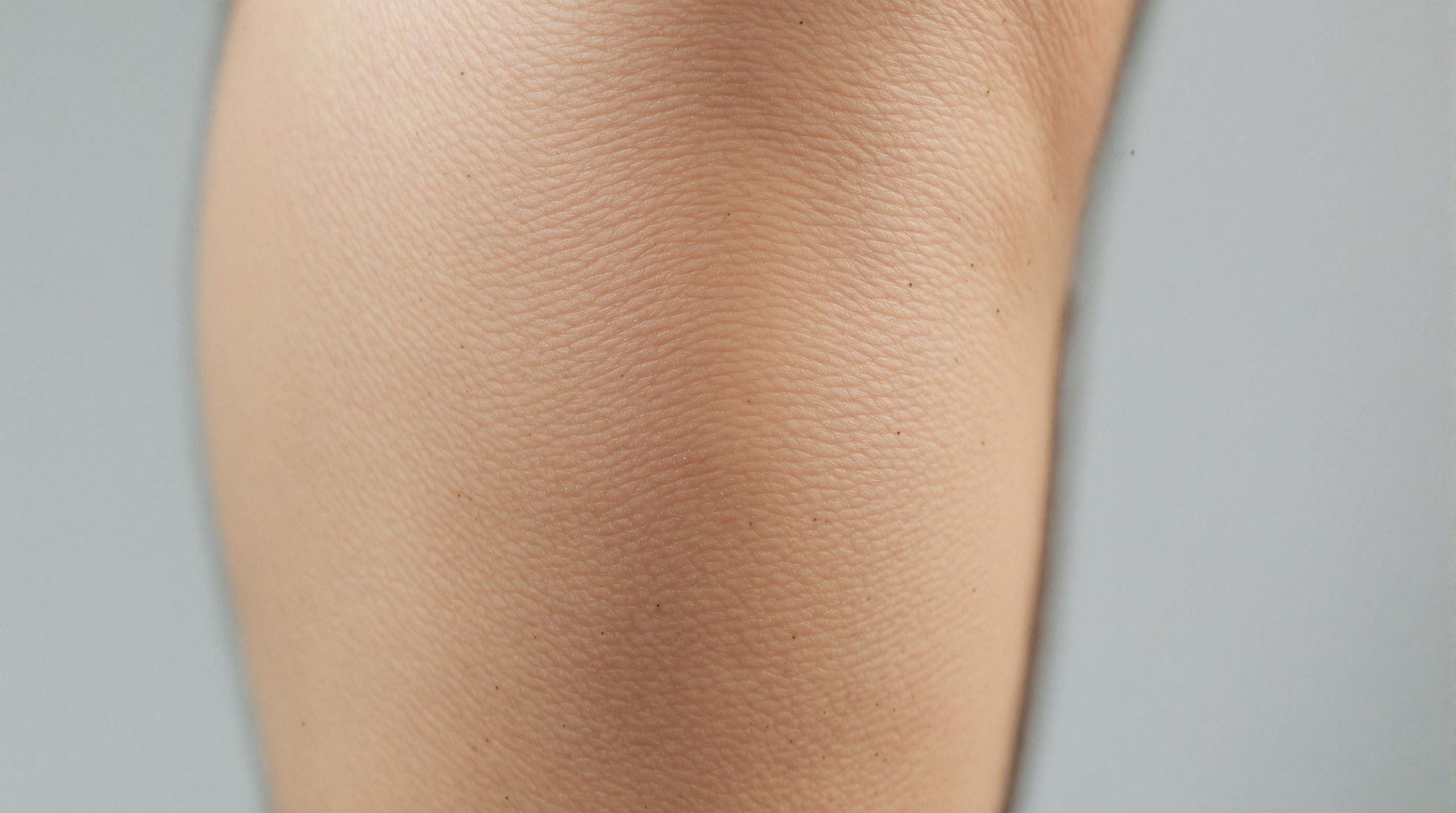 Comprendre et traiter les vergetures sur les mollets - Cosmetique etoile