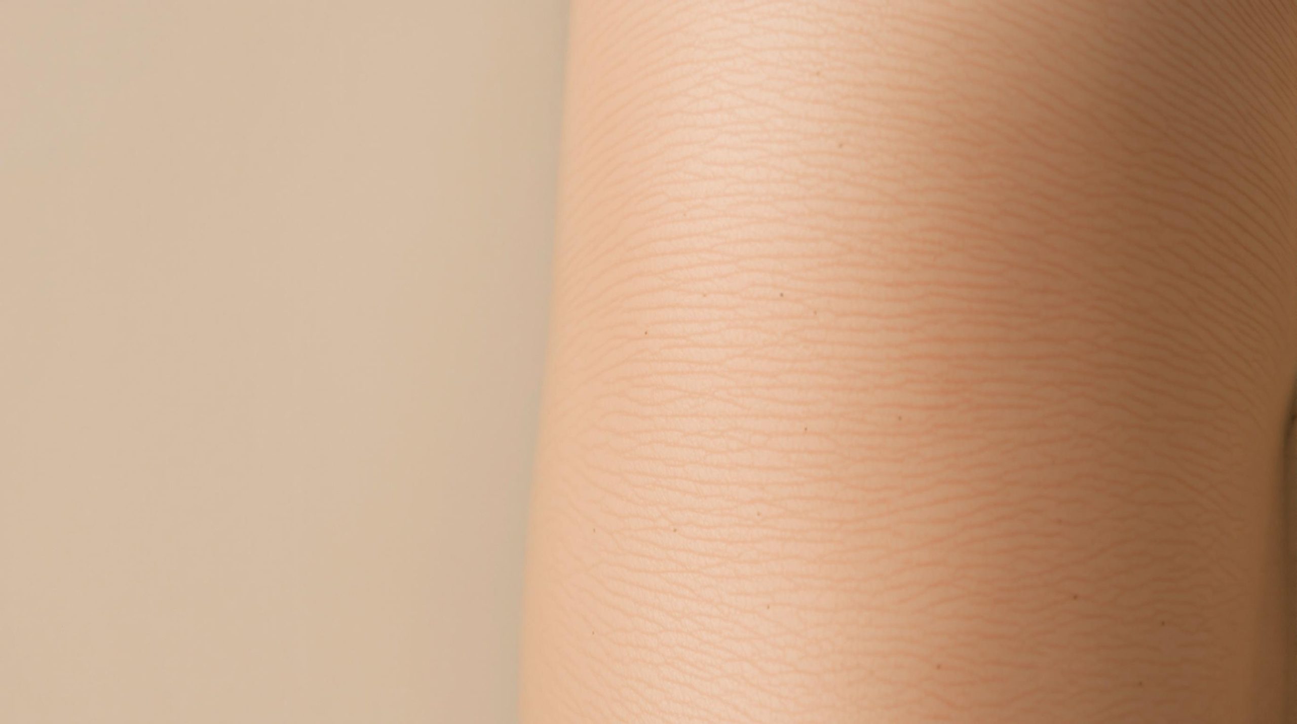 Tout savoir sur les vergetures au niveau des genoux - Cosmetique etoile